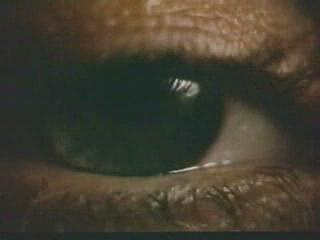 White Of The Eye