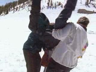 Frostbite