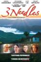 3 Needles