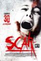 Scar 3D